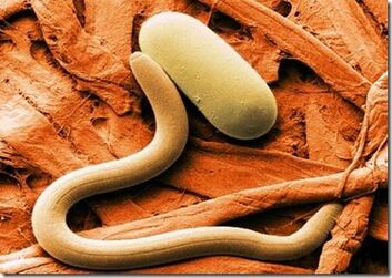 Types de parasites